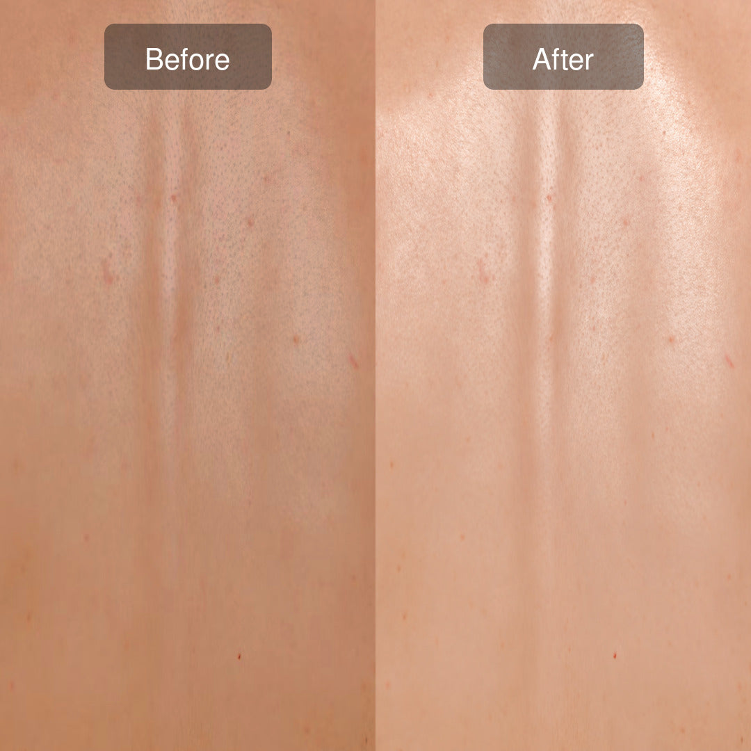 SkinReset Electric Shower Brush