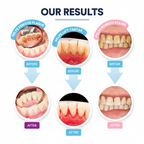 UltraClean Pro Results